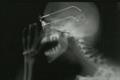 Tomorrow's Talent: Renault, x-rays