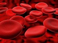 A Unique Child Health: A Doctor's Diary ... Sickle cell anaemia A Unique Child Health: A Doctor's Diary ... Sickle cell anaemia