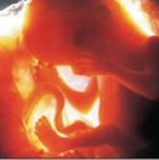 A unique child - the developing brain: Part 1 - Life before birth A unique child - the developing brain: Part 1 - Life before birth