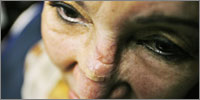 cosmetic surgery