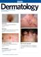 MIMS Dermatology
