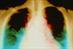Heart failure may be improved by lowering heart rate (Photograph: SPL)