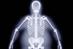 NICE believes patients with a BMI over 40 will benefit from surgery (Photograph: SPL)