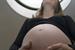 Pregnancy: DoH in agency hunt