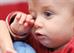A Unique Child: Health - A doctor's diary ... eye infections A Unique Child: Health - A doctor's diary ... eye infections