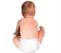 A Unique Child: Health - A doctor's diary ... Nappy rash A Unique Child: Health - A doctor's diary ... Nappy rash