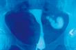 Infertility management and referring patients