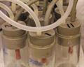 Improving waste-stream quality
