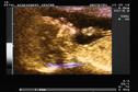 Journals Watch - Antenatal screening and diphtheria