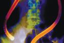 PCTs fail to invest in extra cancer tests