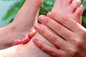 CKS Clinical solutions - Morton's neuroma