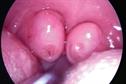Clinical Review: Paediatric obstructive sleep apnoea
