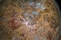 Pictorial case study: itchy scalp