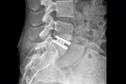 Journals Watch - Low back pain and osteoarthritis