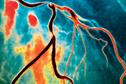 Journals watch - Depression, antibiotics and coronary artery disease