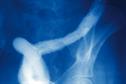 Journals Watch - H1N1 vaccine, obesity and hearing loss