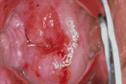 Journals Watch - Chlamydia and heart failure