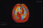 Alzheimer Society 'brain scan' by Rethink Canada