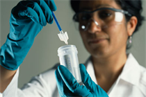 Cervical smear test