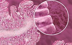Linaclotide recommended in updated NICE IBS guideline