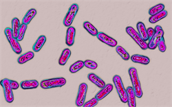 New antibody prevents recurrence of Clostridium difficile infection