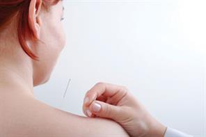 Acupuncture for pain relief
