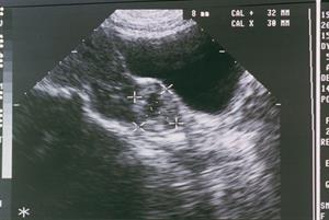 Red flag symptoms: Recognising pregnancy problems