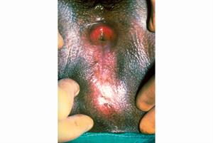 Viewpoint: Recognising FGM in primary care