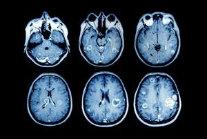Why GPs need better access to diagnostic cancer scans