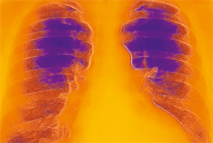 Clinical Review: Heart failure