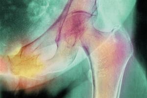 Clinical Review: The menopause
