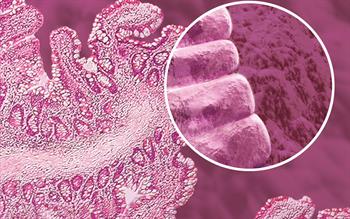 Linaclotide recommended in updated NICE IBS guideline