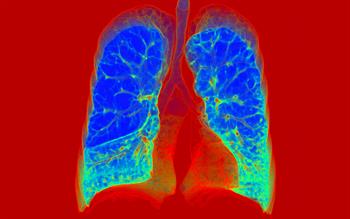 COPD treatment approved for routine NHS use