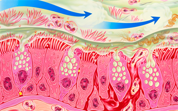 NICE approves mepolizumab for refractory eosinophilic asthma