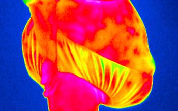 New obesity treatment targets appetite and reward pathways in the brain