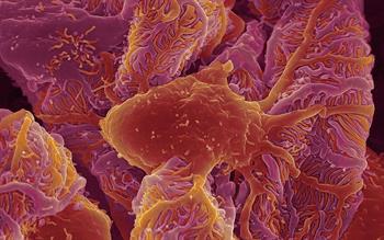 Renal impairment warnings relaxed for metformin products