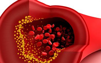New lipid-lowering antibody evolocumab provides additional benefit to statins