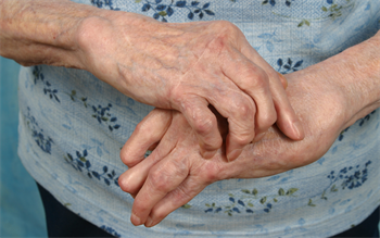 Tofacitinib: new type of rheumatoid arthritis treatment launches