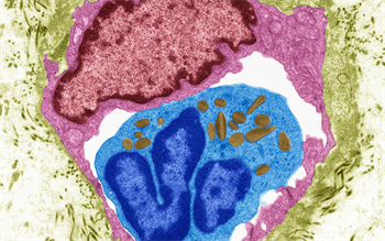 New injectable antibody treatment for asthma