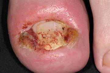Foot conditions: illustrated