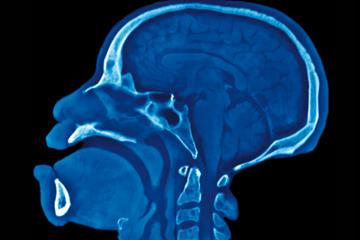 Evidence base: Acromegaly