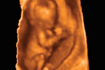 Protein levels key to infertility and miscarriage