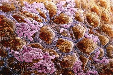 Irritable bowel syndrome: clinical review
