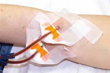 Evidence base: Acute kidney injury