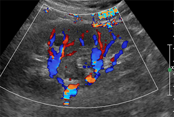 Illustrated: scans and X-rays