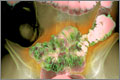 Red flag symptoms: Abdominal pain