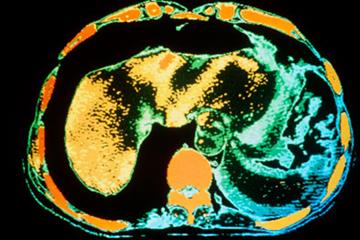 Case study - A confusing presentation of abdominal pain