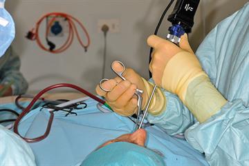 Laparoscopy: illustrated