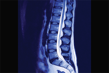 Journals watch: Diagnostic imaging for back pain and blood testing for heart failure