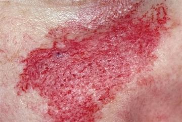 Vascular conditions: differential diagnosis